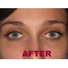 Eyelash Extensions